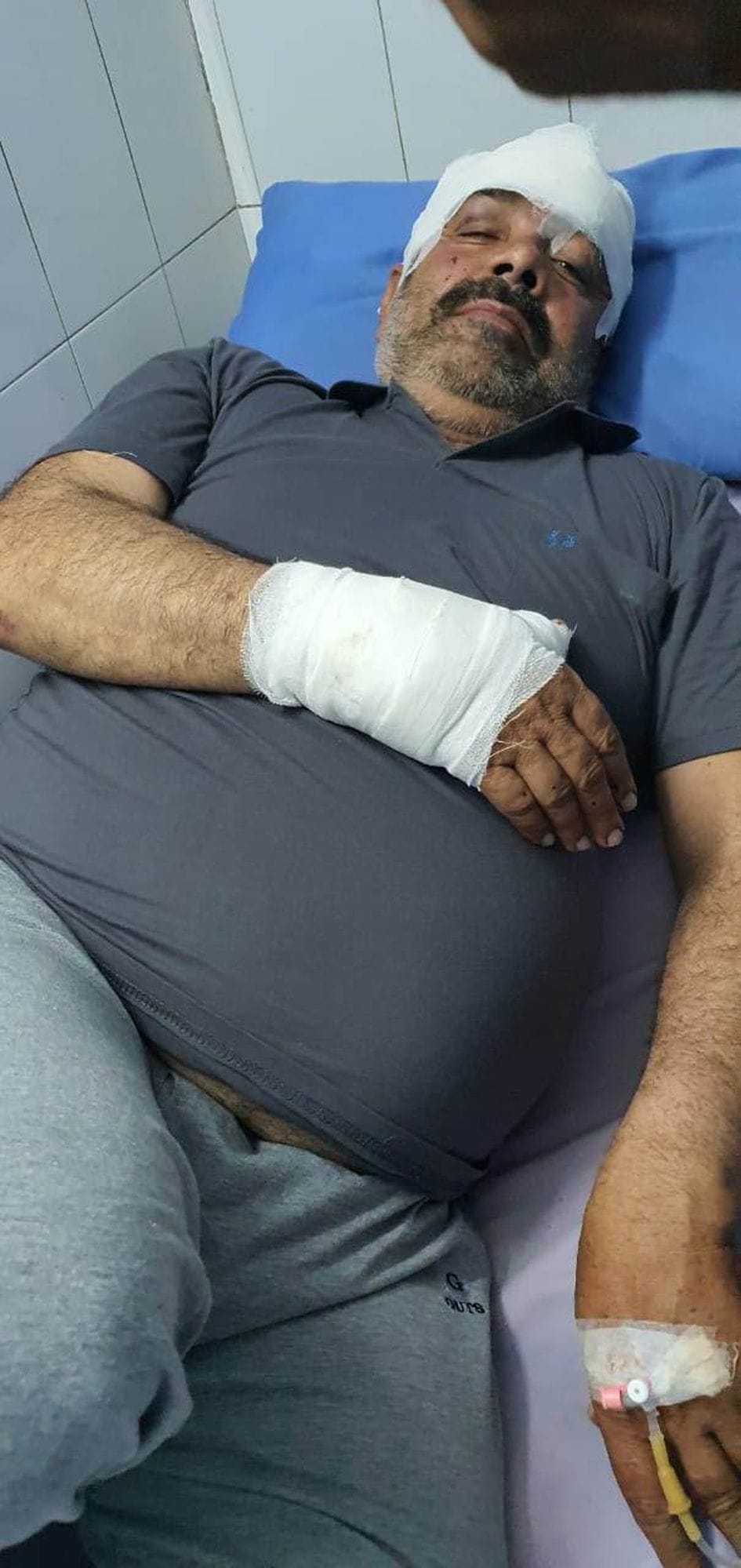 shooted bjp leader while asking vote