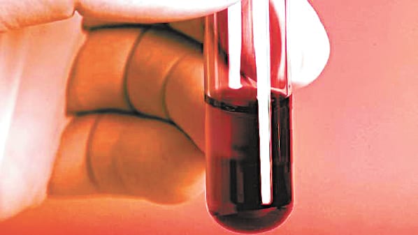 Scarcity of blood in medical institute of lucknow
