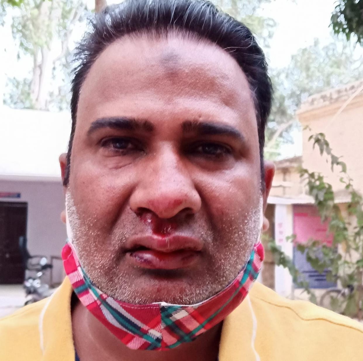 Brick stone among the candidates for the post of prime minister, seven injured