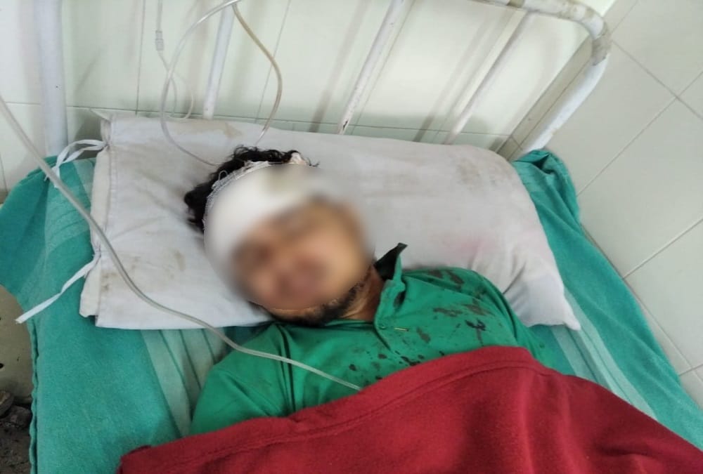 Uttarakhand Accident News: Father And Daughter Died Before Her Marriage in Almora Photos