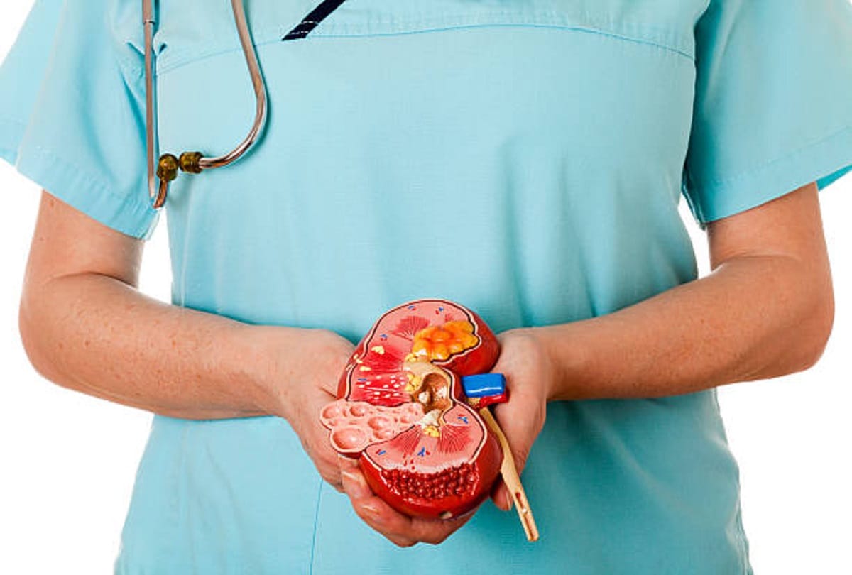 Kidney Stone How Kidney Stones Start Forming Know Common Facts and Causes in Hindi