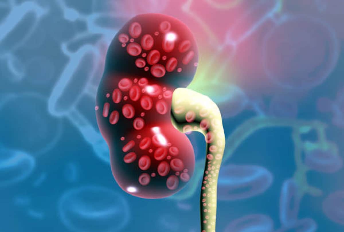 Can hypertension cause chronic kidney disease, all you need to know about this