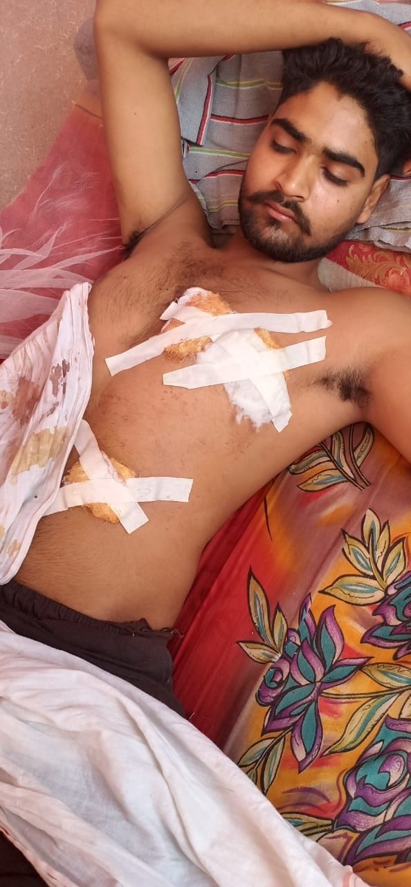 young man injured in attack