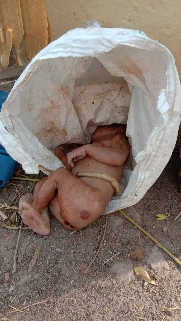 One day girl found in roadside bag, condition critical