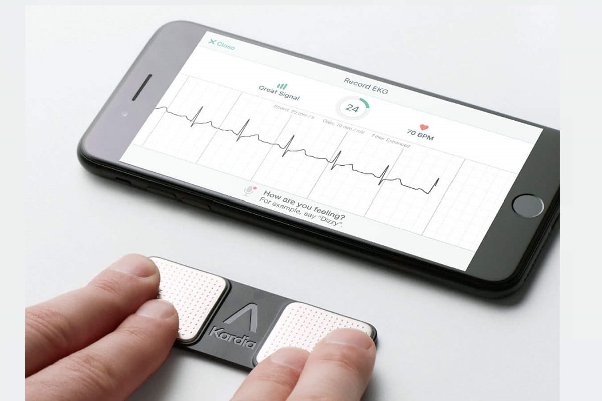 ECG monitor