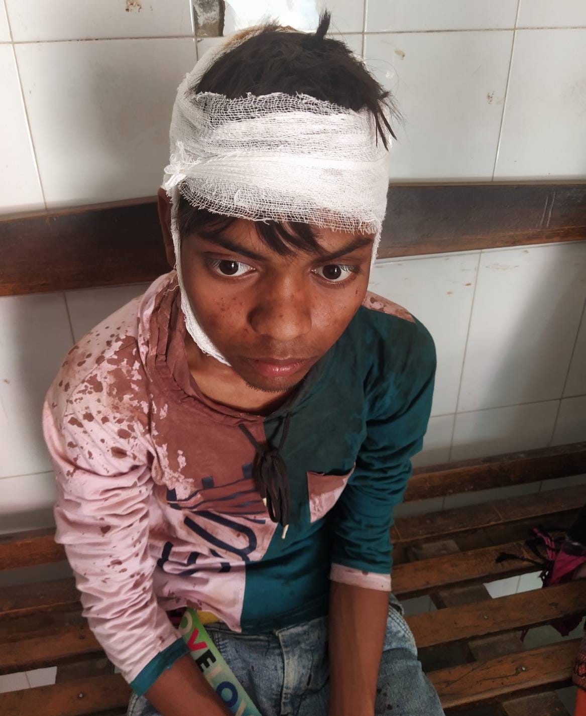Teenager beaten up injured in old enmity