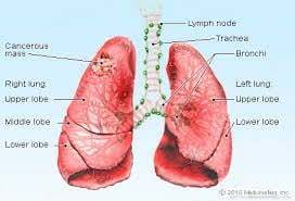 covid maleria precaution