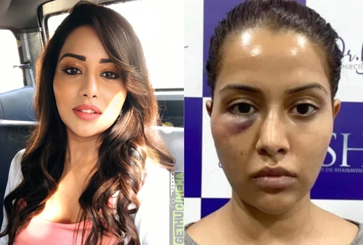 Raiza Wilson Seeks ₹1 Crore In Damages From Doctor After Dermatological Procedure