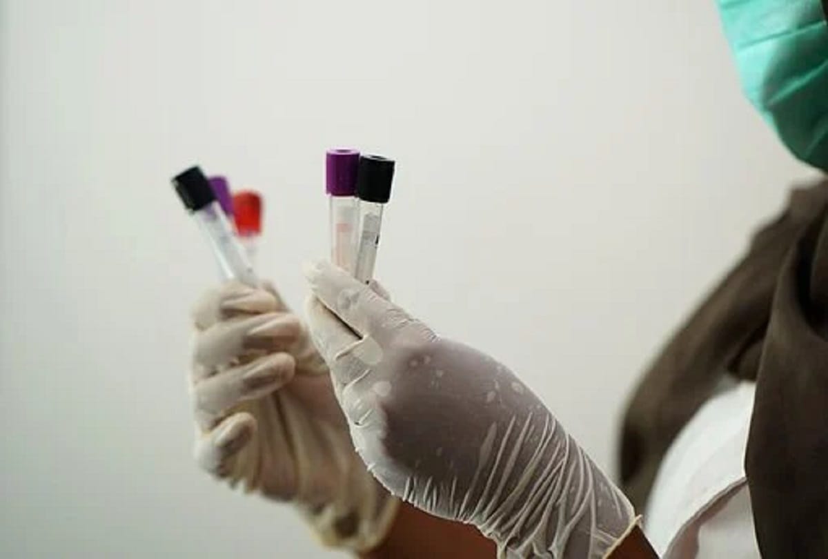coronavirus symptoms but covid test report negative reasons rtpcr test