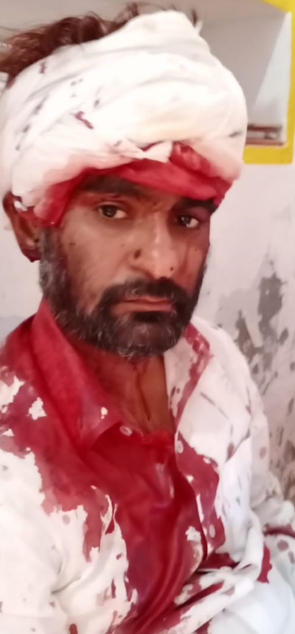 Four including the outgoing village head were injured by beating in Ghazipur