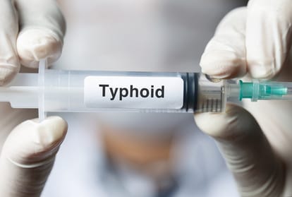 Typhoid is reaching from one city to another like Corona 2 crores affected every year 1.6 lakhs killed