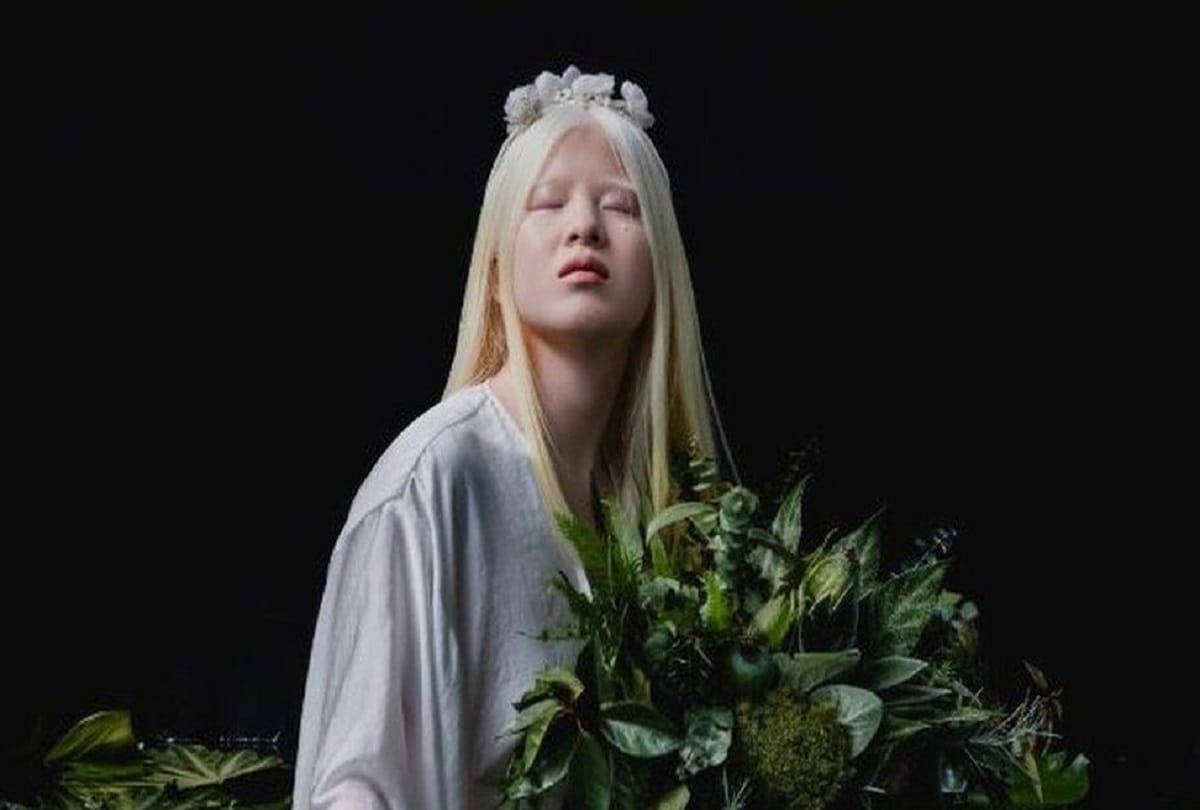 Xueli Abbing: The abandoned baby who became a Vogue model