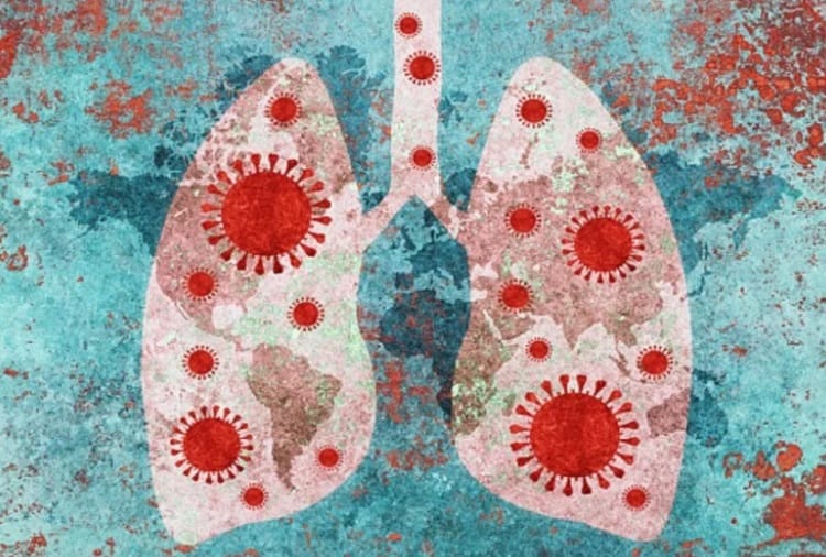 New Strain of Coronavirus Attacks Lung Patient