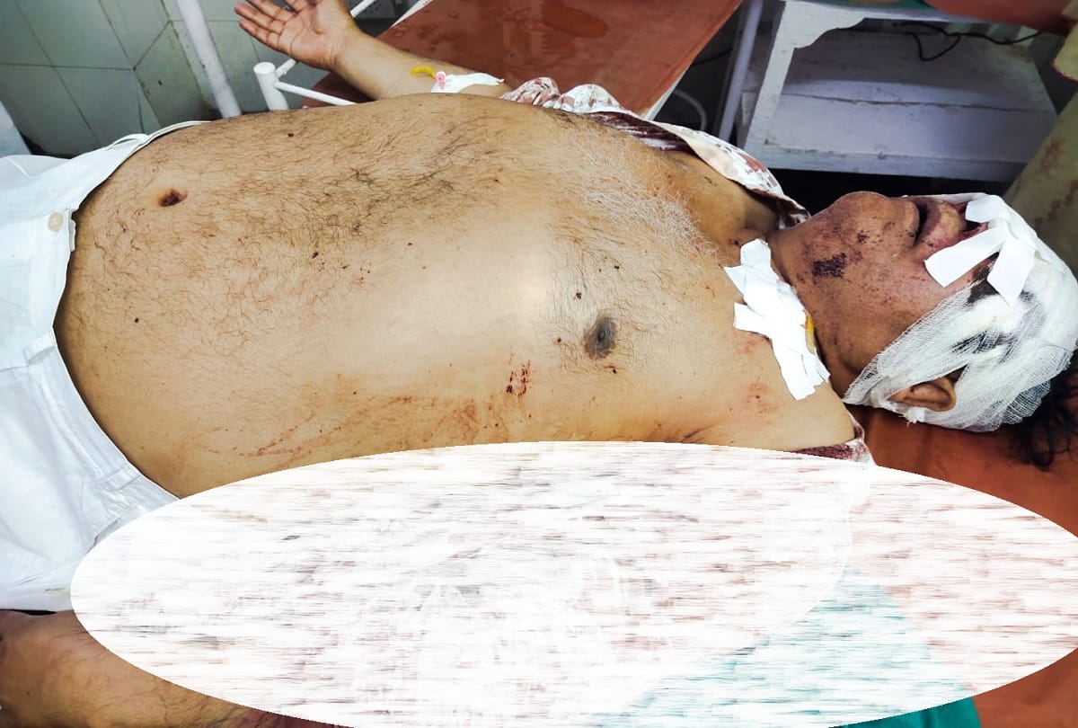 murderous attack on former state Congress Vice President Bablu in electoral rivalry in rampur