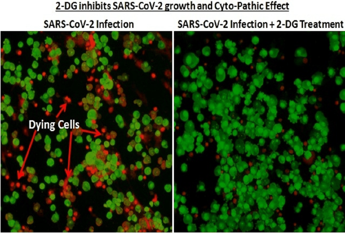 2-DG medicine will be a game-changer: Virus will suffocate in the infected patients body, will also reduce the dependency on oxygen