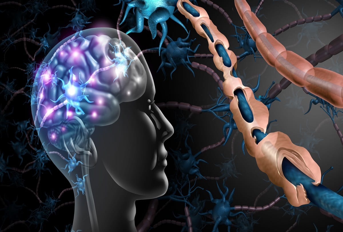 health tips What is Aspergers Syndrome? Elon Musk also has this disease