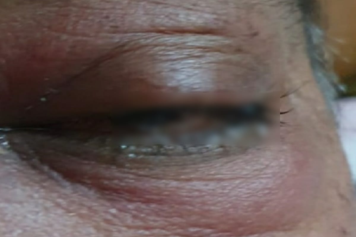 elderly no longer visible after operation in etah