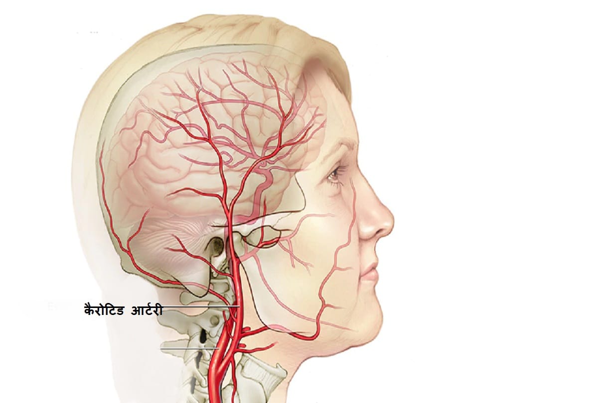 Black fungus attack on eyes through carotid artery in the throat
