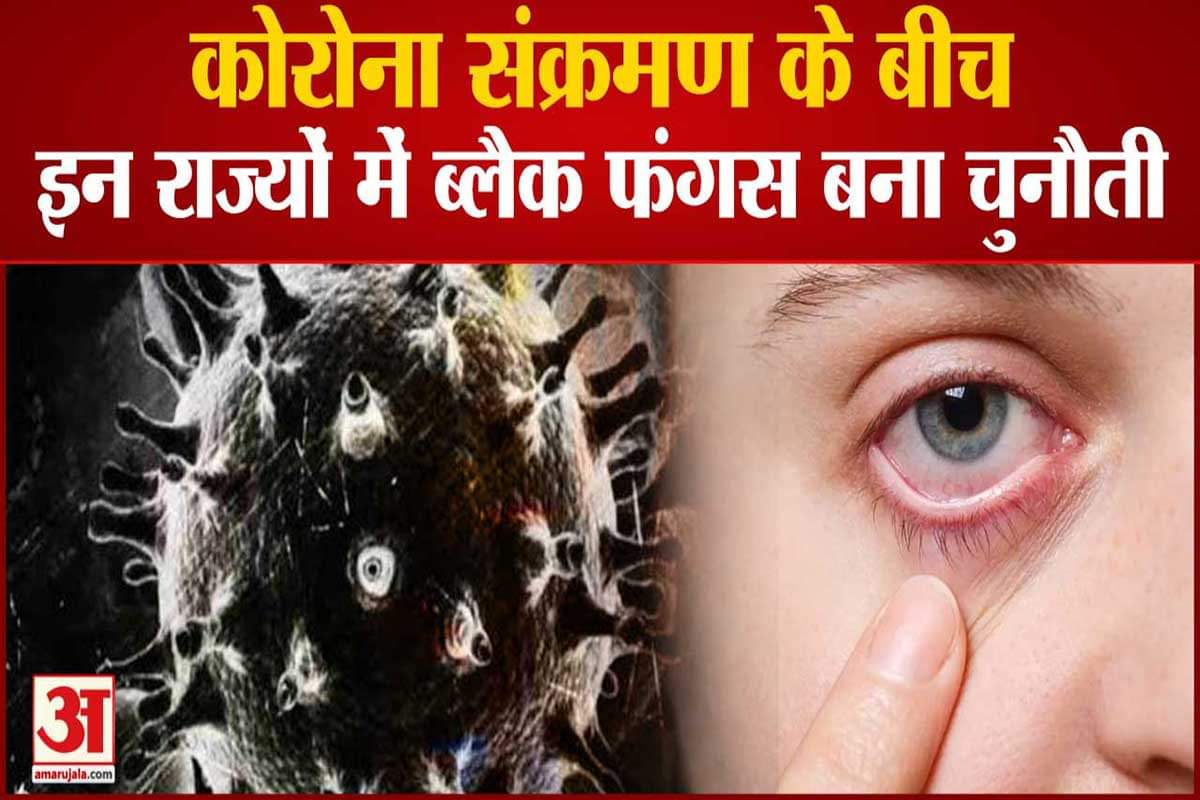 देश के कई राज्यों में बढ़े ब्लैक फंगस के मामले