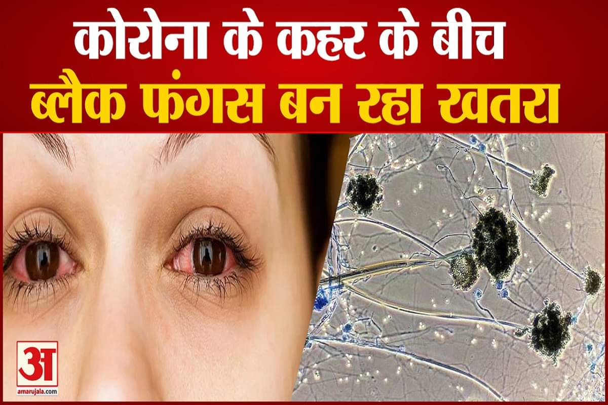 ब्लैक फंगस