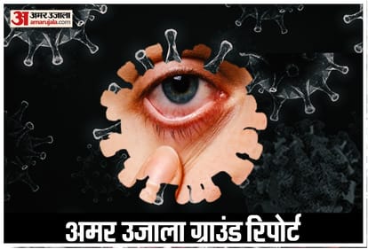 Black Fungus Mucormycosis spreading rapidly amid corona infection in uttar pradesh uttarakhand punjab and delhi
