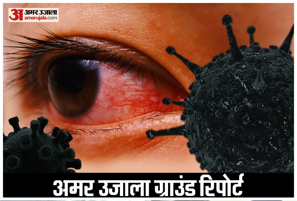 Sudden nasal congestion is a major symptom of black fungus