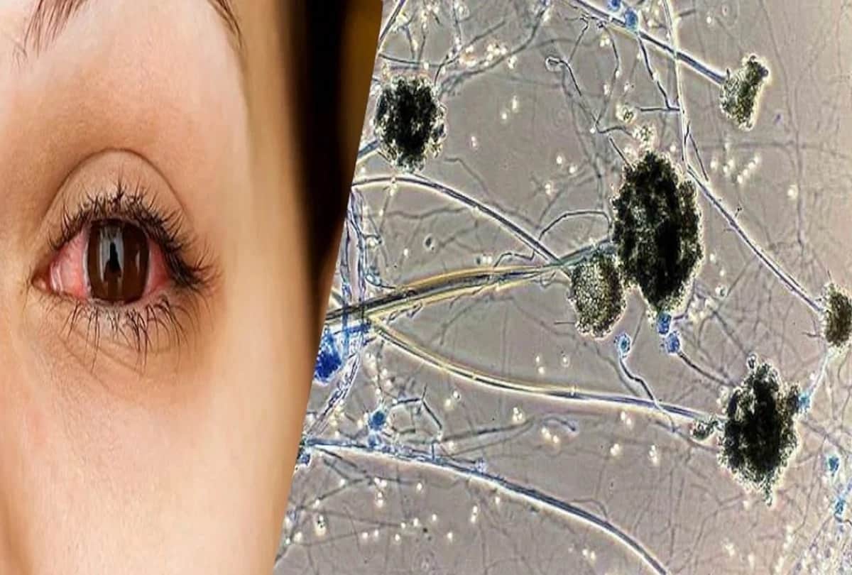 white fungus 17 patients and six more black fungus patients found in Gorakhpur