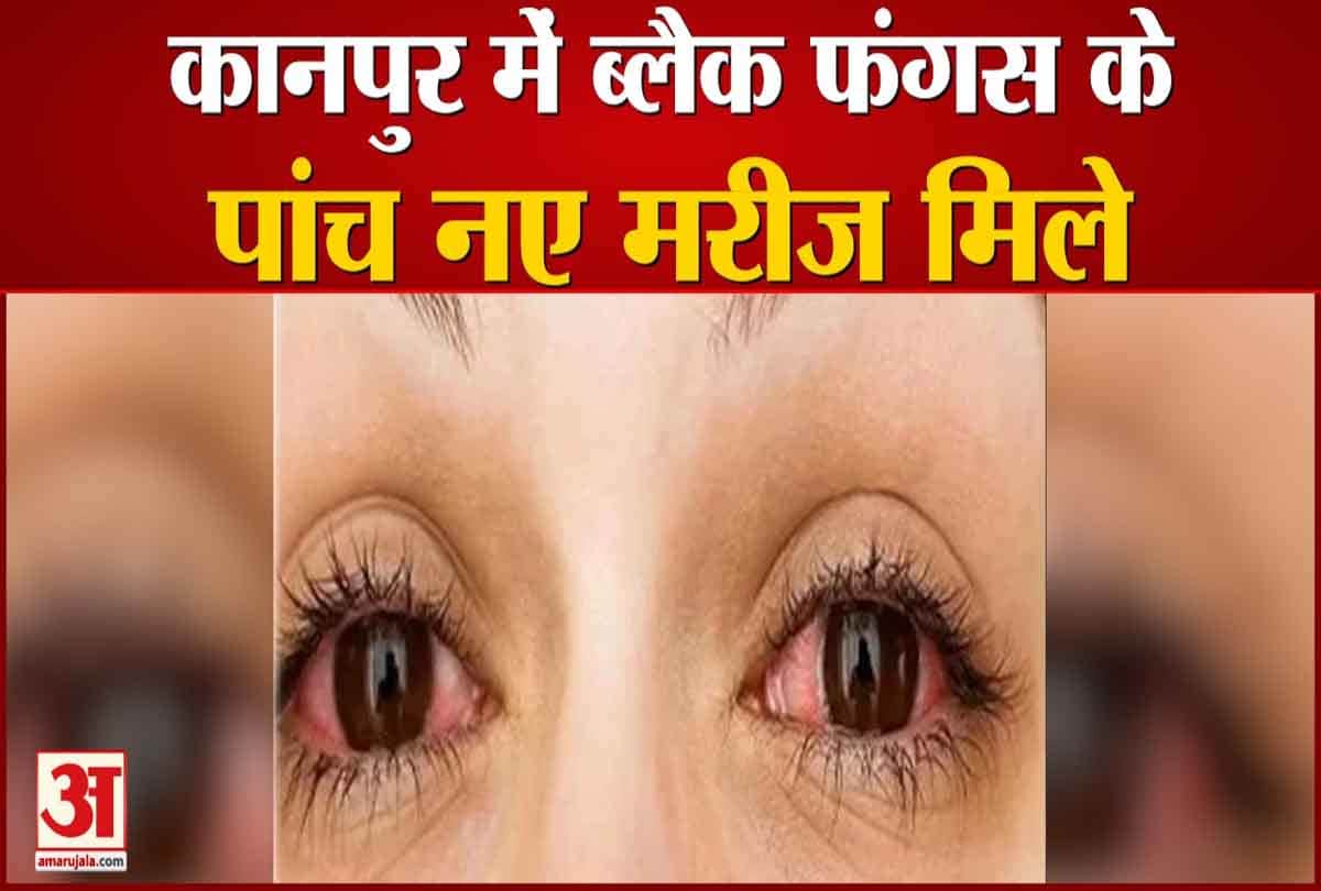 ब्लैक फंगस