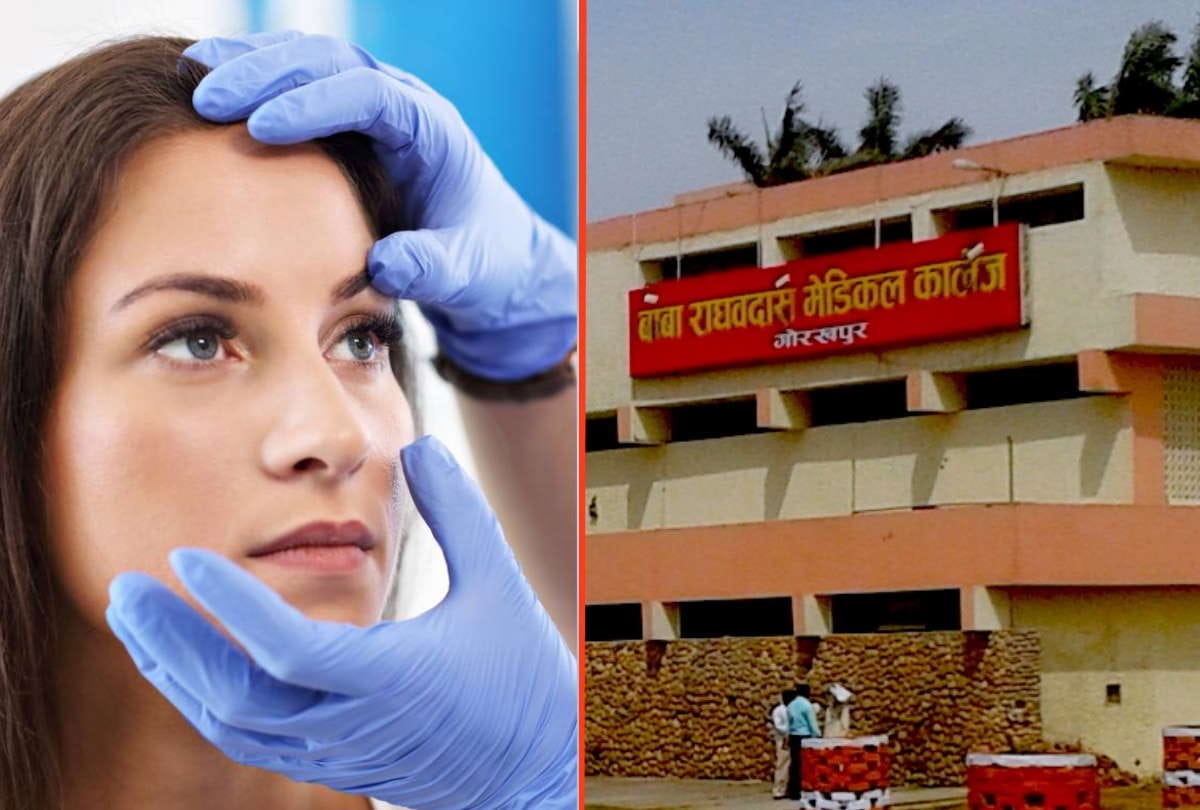 Black fungus patients will be treated in Gorakhpur BRD medical college