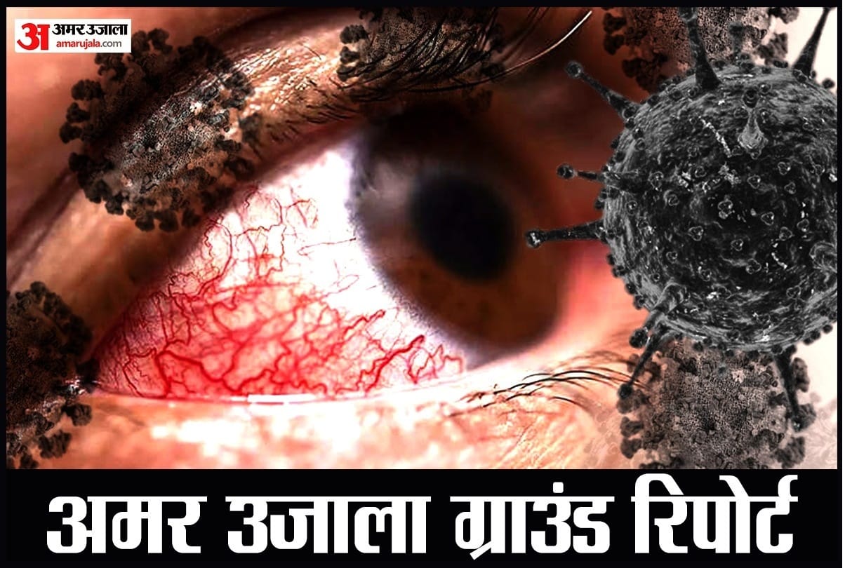 Black Fungus Mucor Mycosis spreading rapidly amid corona infection in Uttar Pradesh Uttarakhand Himachal Pradesh Punjab Delhi