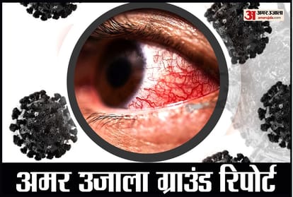 Black Fungus Mucor Mycosis spreading rapidly amid corona infection in Uttar Pradesh Uttarakhand Himachal Pradesh Punjab Delhi