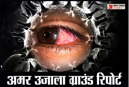 Black Fungus Mucor Mycosis spreading rapidly amid corona infection in Uttar Pradesh Uttarakhand Himachal Pradesh Punjab Delhi