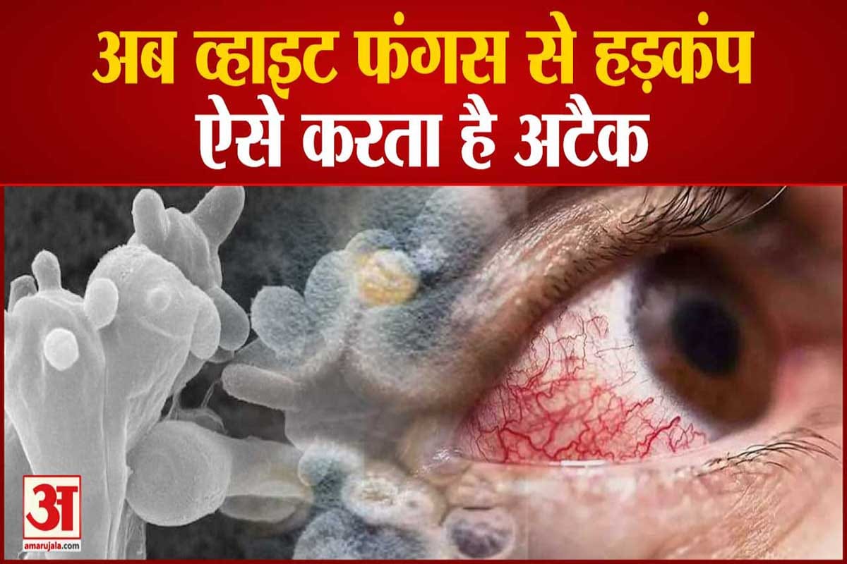 White fungus patient found in Mau treatment in varanasi he was corona positive in april