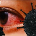 Black fungus