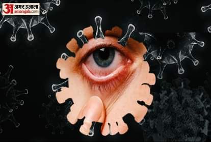 ब्लैक फंगस (सांकेतिक तस्वीर)