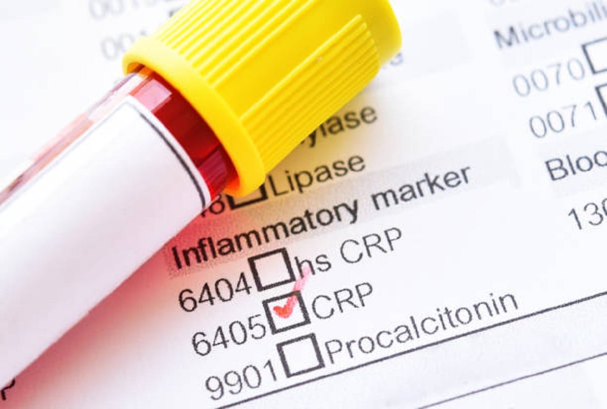 Coronavirus what is crp test how crp test useful in covid 19