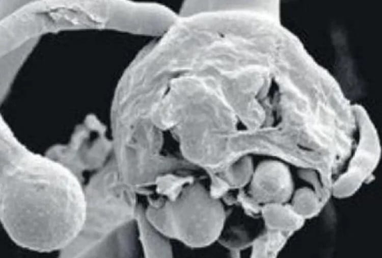 White fungus is more dangerous 