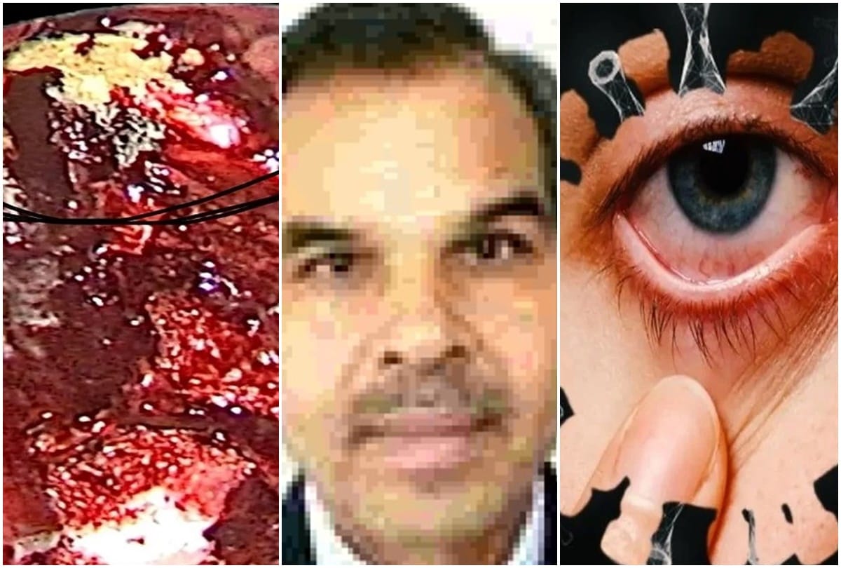 chief scientist dr gl sharma said many colors of fungus can be seen in upcoming days