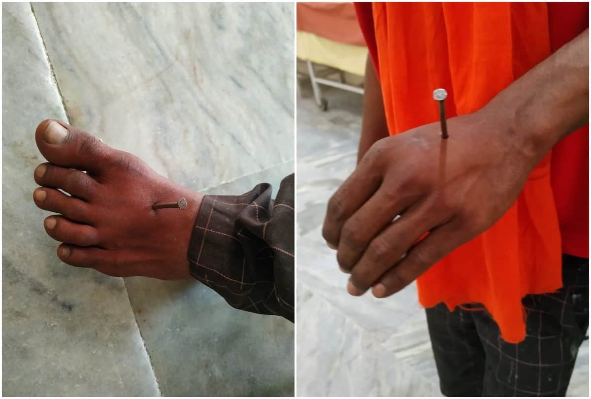 New twist in case of nail in hand and foot young man himself hitting nails in hand and feet