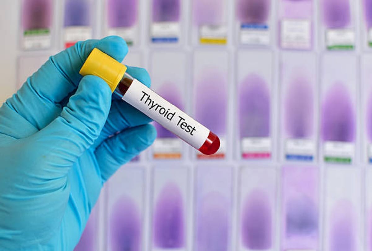 what to avoid in thyroid problem , thyroid disorders prevention and control