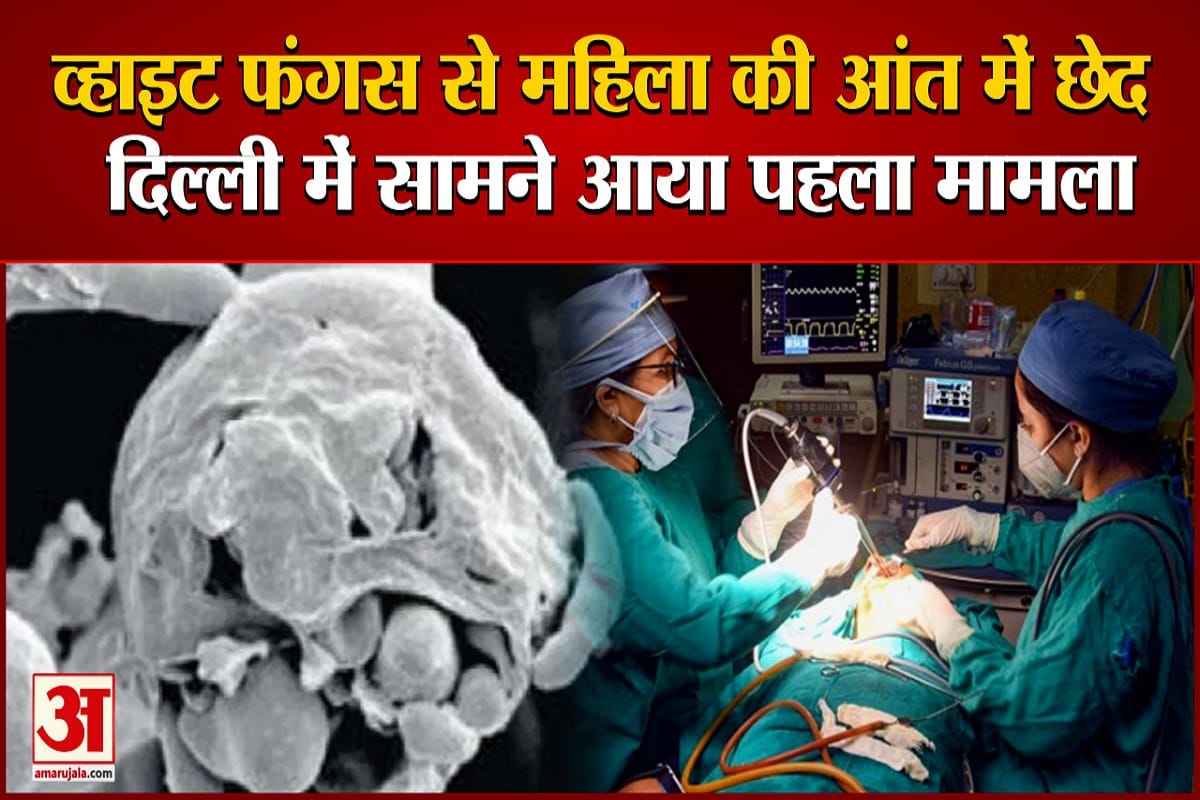 व्हाइट फंगस