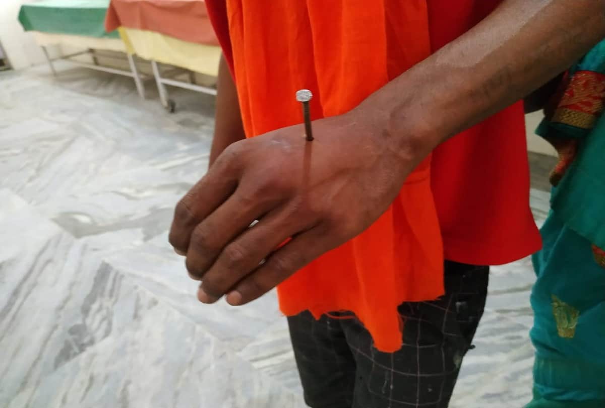 New twist in case of nail in hand and foot young man himself hitting nails in hand and feet