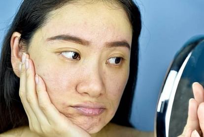 Summer Skincare Tips Check Homemade Natural Remedies to Prevent Skin From Scorching Heat