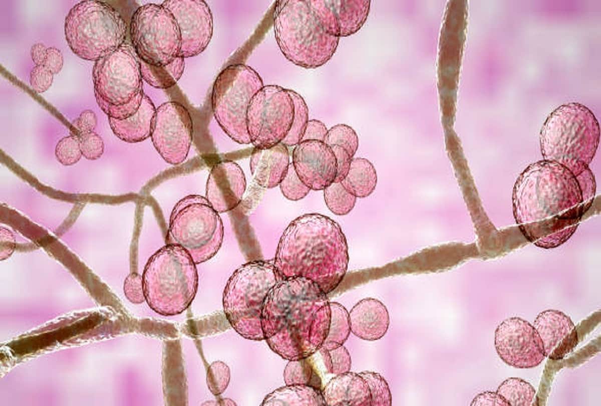 Do not eat these things to avoid fungal infection diet in hindi