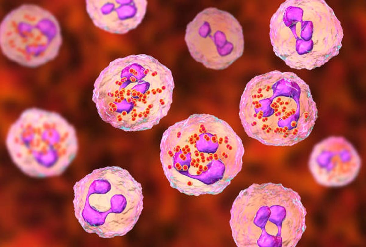 Meningococcal meningitis serious bacterial infection causes and symptoms