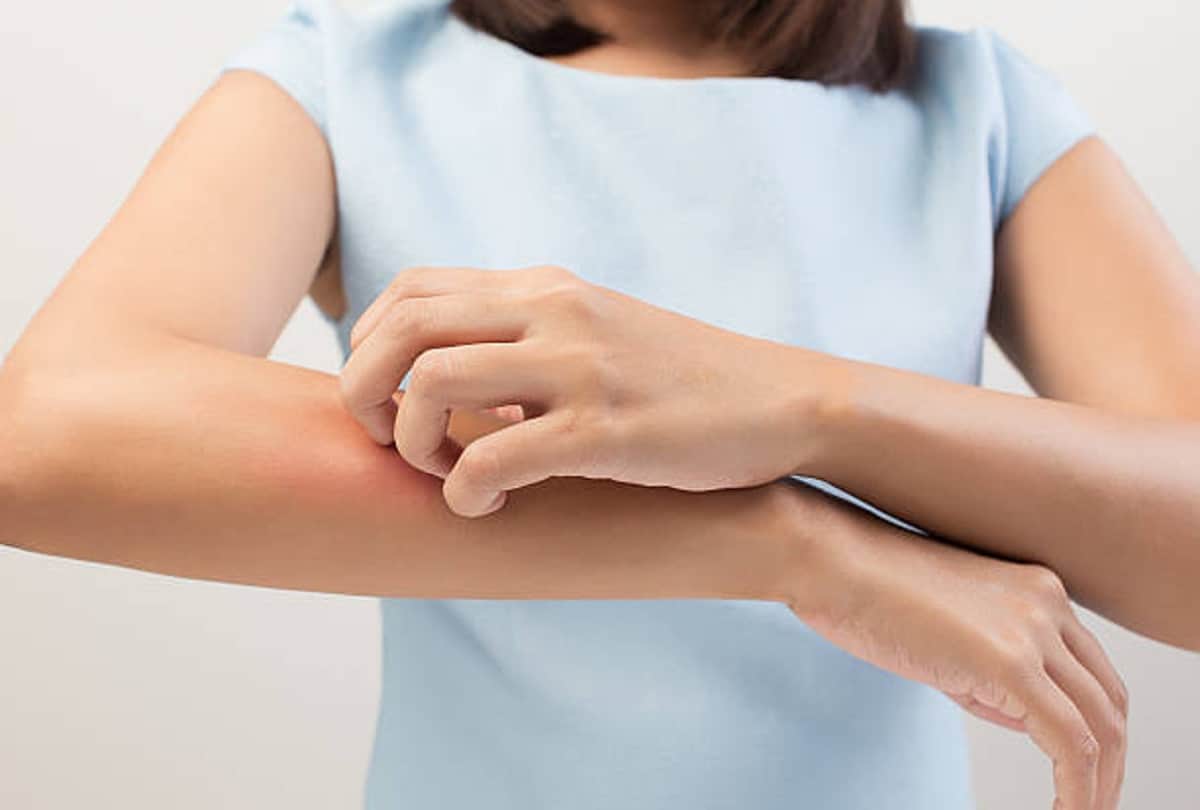 Skin Care Tips in monsoon home remedies for get rid from itching and allergy in hindi