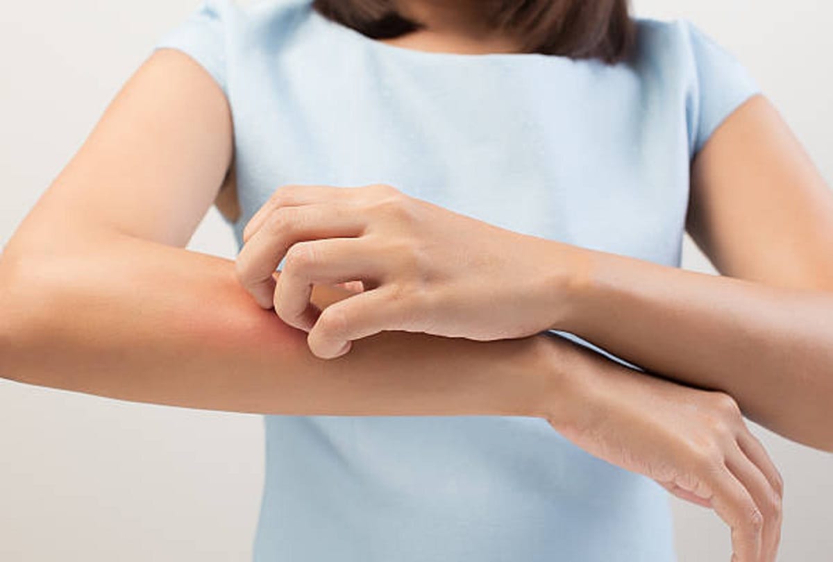 Skin Care home remedies for get rid from itching and allergy in hindi