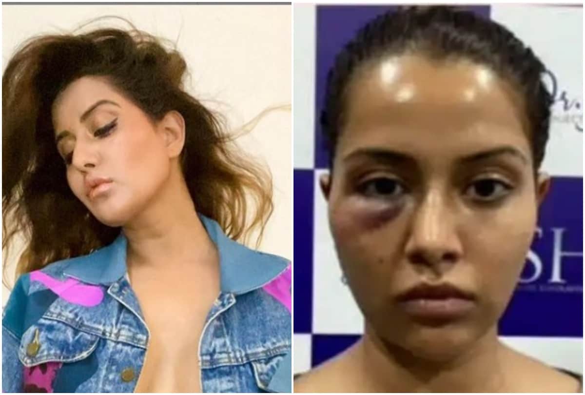 Raiza Wilson Who Accused Her Dermatologist of Wrong Treatment, Sets Instagram on Fire With Her new photoshoot