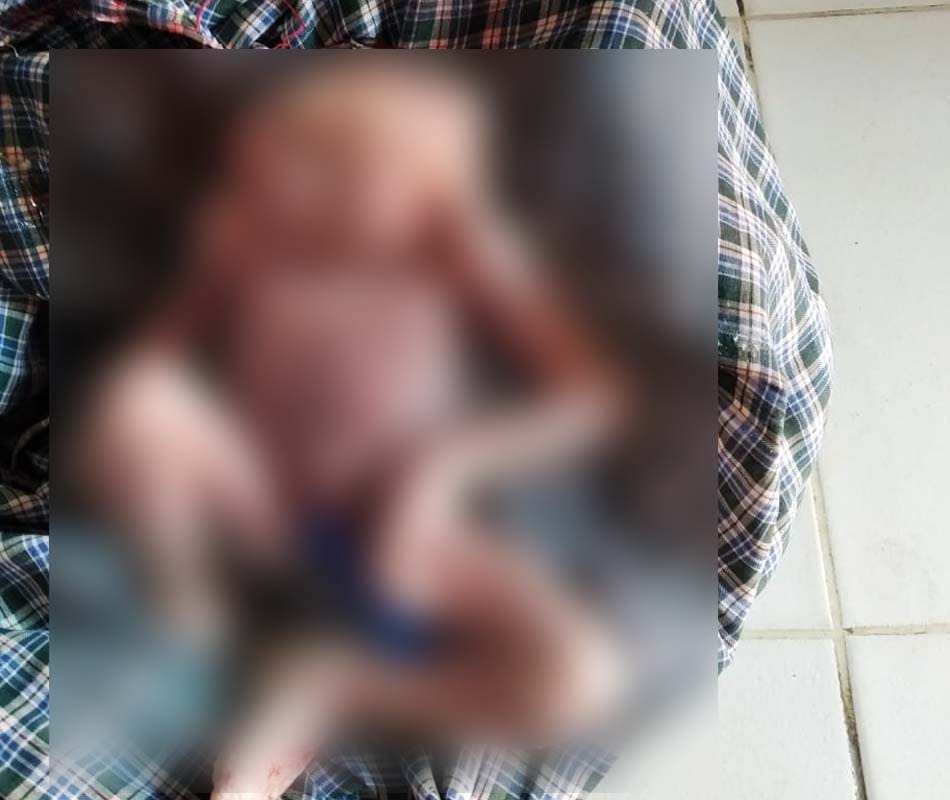Bizarre Child born with eight eyes nose mouth in varanasi