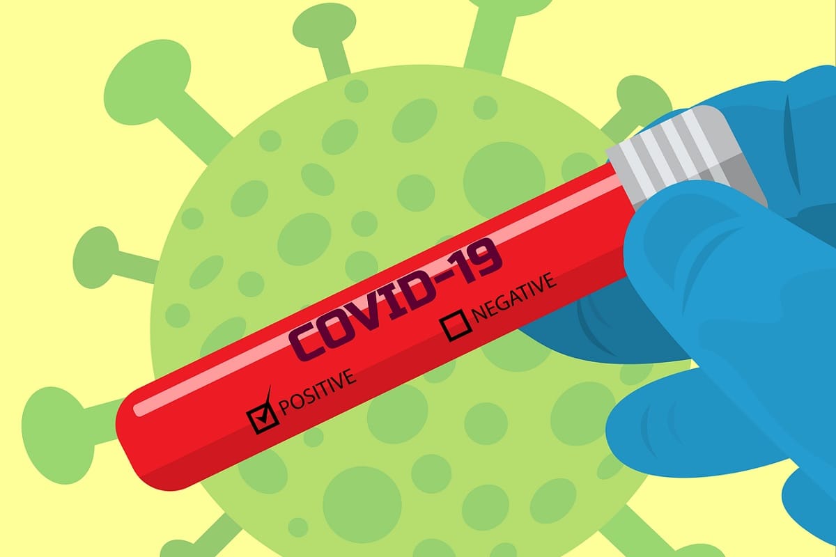 Comorbidities were found to be predominantly present in the deceased covid patients